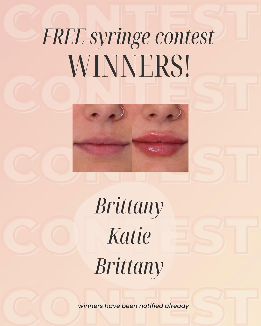 Ultimate Image | Tampa & Clearwater | Botox • Fillers • Fraxel Beauty Giveaways by Womens-Resources