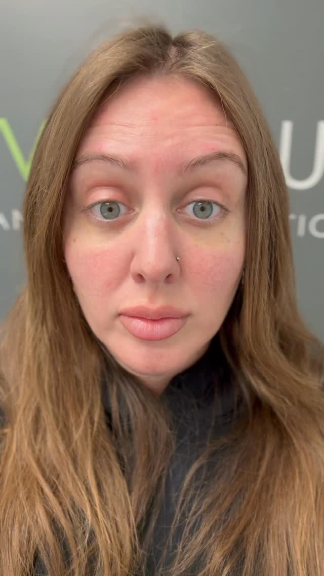 4Ever Young Anti-Aging Solutions - Philadelphia Beauty Giveaways by Womens-Resources